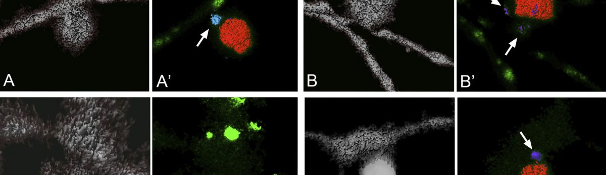 Images of Mitochondria. Four slides showing the progression/evulsion of dendritic arbors of ganglion cells. Black background. Gray dendritic structure with sporadic splotches of red and bright green.