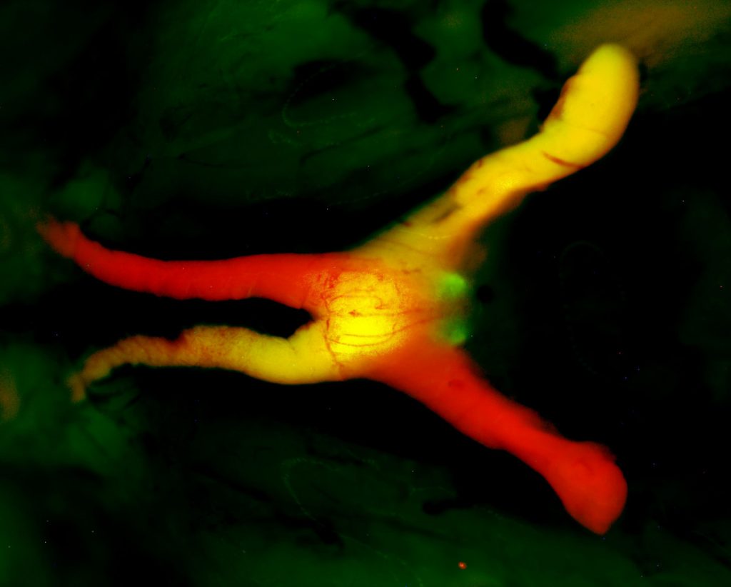 Glowing red and yellow nerve branching over a black and green mottled background.