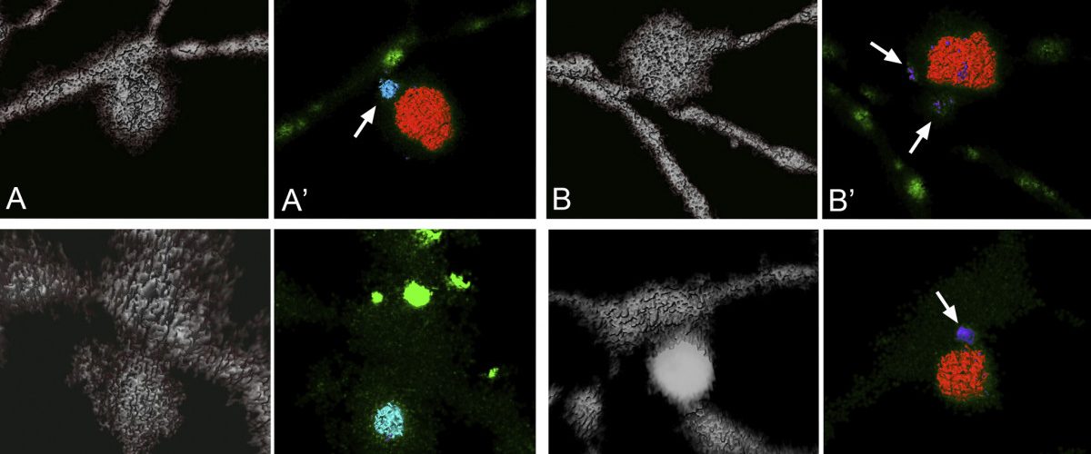 Images of Mitochondria. Four slides showing the progression/evulsion of dendritic arbors of ganglion cells. Black background. Gray dendritic structure with sporadic splotches of red and bright green.