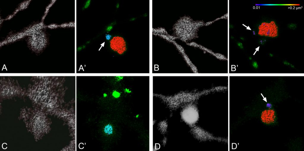 Mitochondrial Dynamics – Nickells Lab – UW–Madison